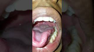 Tied up gummy worm gets swallowed FAST!