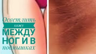 Как осветлить кожу между ног и в подмышках?