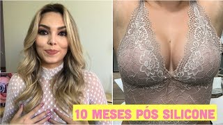 SILICONE - 10 MESES PÓS CIRURGIA | Velha de Vinte