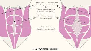 Диастаз прямых мышц живота.  Что это и как узнать, есть ли он у вас? Как восстановиться после родов