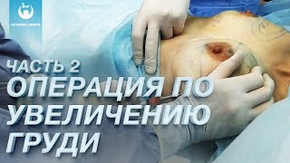Операция по увеличению груди у Сергей Хаустов. Пластическая хирургия в Клинике GENESIS DNEPR Часть 2