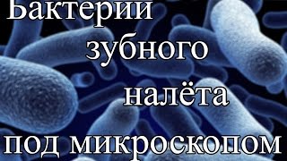 Как увидеть бактерии зубного налета в школьный микроскоп