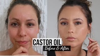 30 Days of Castor Oil For Eyebrow Growth