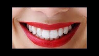 হলুদাভাব দাঁতের কারণ ও দাঁত সাদা রাখার উপায় ||