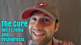 The Cure for Eczema/Dyshidrosis