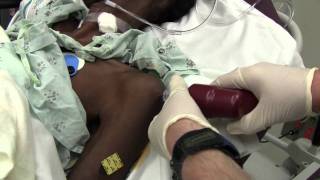 6 Mistakes in Awake Adult IO Infusion