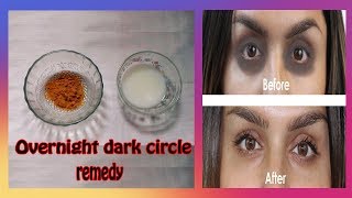 How to remove dark circles overnight
