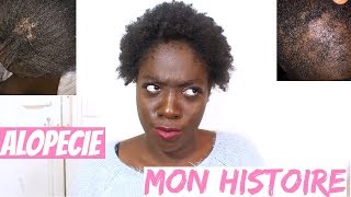 J'AI PERDU MES CHEVEUX A CAUSE DU DÉFRISAGE ! I Aika L.