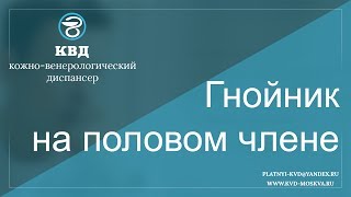 66  Гнойник на половом члене