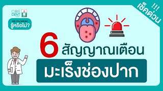 วิธีเช็คว่าเป็นโรคมะเร็งช่องปากหรือไม่