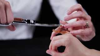 Anti swan neck orthosis (Orfit Strips) - Splinting techniques 7/10