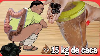 recette de grande mère pour débarasser LE COLON définitivement des PARASITES INTESTINAUX ou VERS