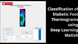 Classification of Diabietic Foot Thermograms using Deep Learning Matlab