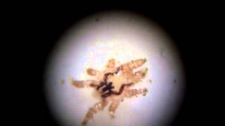 Mites (Acari: Spinturnicidae: Meristaspis) from Egyptian Fruit Bat, Rousettus aegyptiacus