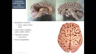 VÍDEO AULA #8 NEUROANATOMIA   ANATOMIA MACROSSCÓPICA DO SNC PARTE 3   TELENCÉFALO