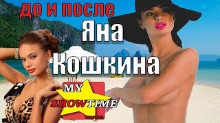 ЯНА КОШКИНА ГОЛАЯ ПРАВДА YANA KOSHKINA NAKED TRUTH№2 До и После ПЛАСТИКИ  my showtime #8