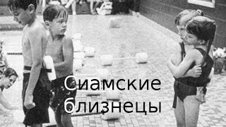 Сиамские близнецы