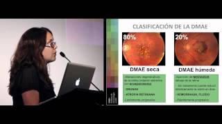 Degeneración Macular (DMAE). Dra. Burés de IMO Barcelona (conferencia completa)
