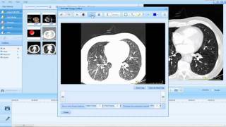 DICOM Presenter