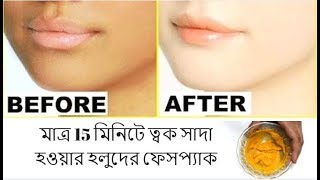 মাত্র 15 মিনিটে ত্বক সাদা হওয়ার হলুদের ফেসপ্যাক II Mim Beauty Tips
