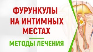 Фурункулы на интимных местах: ТОП методов лечения
