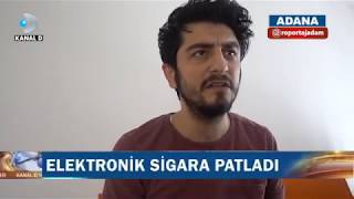 E-Sigara Patlayınca Sis Bombası Atıldı Sanan Adam - Röportaj Adam #7