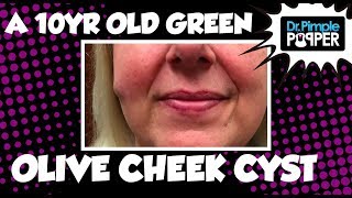 A Ten Year Old Green Olive Hiding in The Cheek