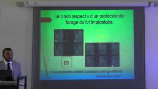 7ème commandement : le forage et la pose d'implant