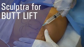 Sculptra Butt Lift at ZO Skin Centre