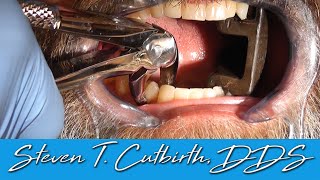 Easy Tooth Extraction - Dental Minute with Steven T.  Cutbirth, DDS