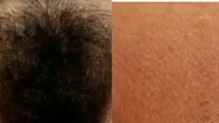 DIY painless Brazilian waxing, at home. For perfect bikini body.