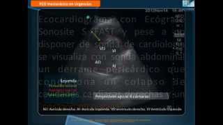 Derrame pericárdico y Taponamiento cardiaco.