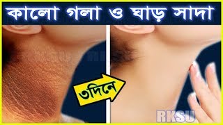 ৩দিনেই গলার কালো দাগ দূর করার টিপস ! ধবধবে সাদা ও ফর্সা গলা পাবেন খুব সহজেই !! Beauty Tips Bangla