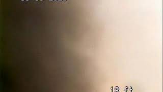 01302020 HICCUPS