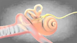Dizziness | Loss of Balance | Vertigo | Hearingloss.com