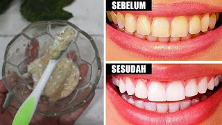 BIKIN TAKJUB! GIGI KUNING BERKARANG JADI PUTIH KEMBALI HANYA RACIKAN INI 