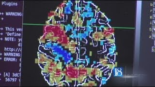 ImPACT testing helps athletes with concussions