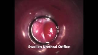 Otoscopic urethral catheterization, female cat urinary tract