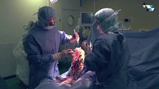 Prothèse de genou avec le bras robotisé MAKO à la clinique TIVOLI