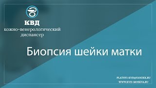 881  Биопсия шейки матки