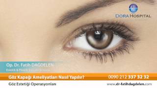 Göz Kapağı Ameliyatları Nasıl Yapılır?