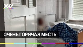 Очень горячая месть. Муж залил жене кипяток в рот