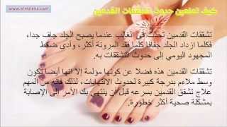 كيف تمنعين حدوث تشققات القدمين