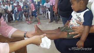 Niño con pierna mas corta recibe milagro y crece de estatura. ¡Grande es Dios!