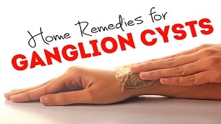 5 Home Remedies for Ganglion Cysts | By Top 5.