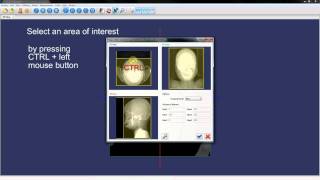 3DimViewer: Chapter 1 DICOM data import