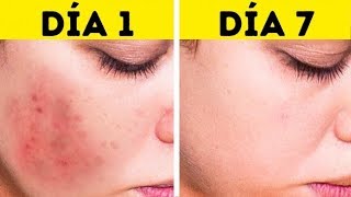 Esto eliminará las manchas de tu rostro en solo 3 noches