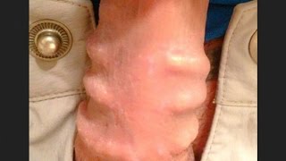 5 ЛЮДЕЙ с НЕВЕРОЯТНЫМИ ПОЛОВЫМИ ОРГАНАМИ 18+
