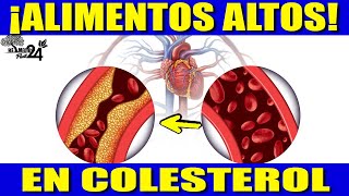 ?PARA DE COMER ESTOS 5 ALIMENTOS QUE SUBEN EL COLESTEROL Y CONOCE LOS ALIMENTOS QUE SÍ PUEDE COMER