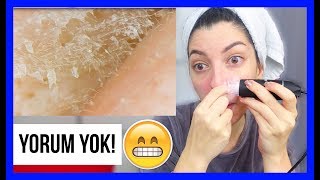 JELATİNLE SİYAH NOKTA TEMİZLEME Mikroskopla İnceleme